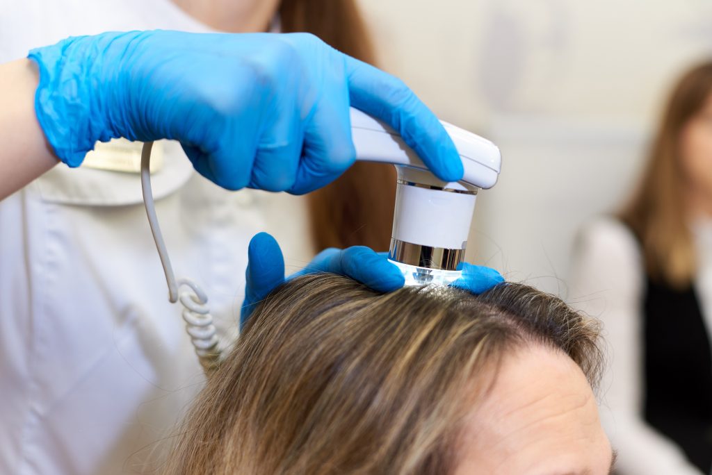 Tricologia Maringá - Exame para avaliar a queda de cabelo.