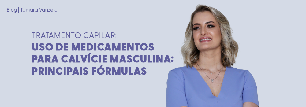 Calvície Masculina